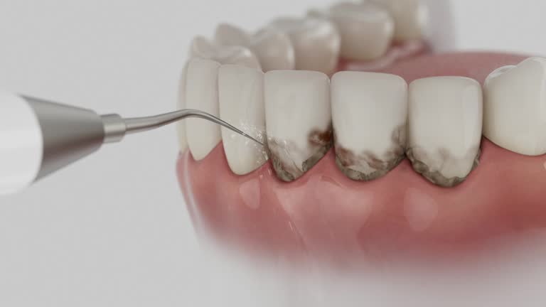 Reliable Dental contractor in Juneau, WI by Smile Center Dentistry